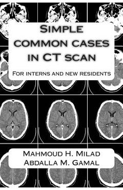 Poza produsului Simple common cases in CT scan: For interns and new residents - Abdalla M. Gamal