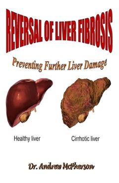 Coperta cărții 'Reversal of Liver Fibrosis: Preventing Further Liver Damage - Andrew Mcpherson'