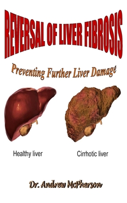 Reversal of Liver Fibrosis: Preventing Further Liver Damage - Andrew Mcpherson
