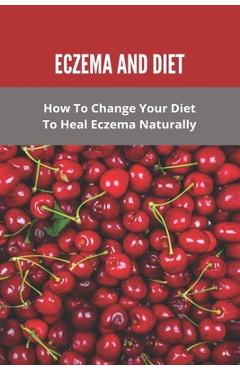 Coperta cărții 'Eczema And Diet: How To Change Your Diet To Heal Eczema Naturally: How To Treat Eczema With Diet - Wendell Marguez'