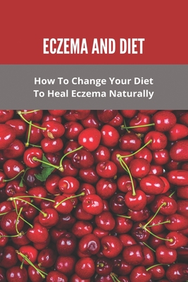 Coperta cărții 'Eczema And Diet: How To Change Your Diet To Heal Eczema Naturally: How To Treat Eczema With Diet - Wendell Marguez'