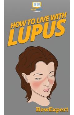 Coperta cărții 'How To Live With Lupus: Your Step By Step Guide To Living With Lupus -'