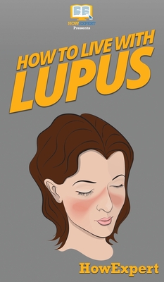 Coperta cărții 'How To Live With Lupus: Your Step By Step Guide To Living With Lupus -'