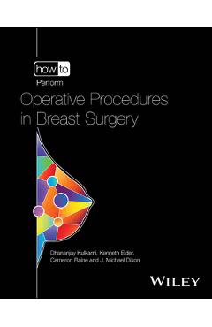 Coperta cărții 'How to Perform Operative Procedures in Breast Surgery - Dhananjay Kulkarni'