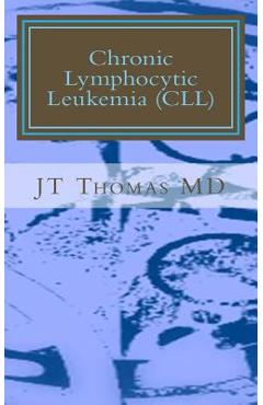 Coperta cărții 'Chronic Lymphocytic Leukemia (CLL): Fast Focus Study Guide - Jt Thomas Md'