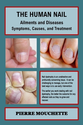 THE HUMAN NAIL - Ailments and Diseases: Symptoms, Causes, and Treatment - Pierre Mouchette