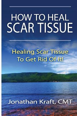 How to Heal Scar Tissue: How to Heal Your Own Scar Tissue And Get Rid Of It! - Jonathan A. Kraft