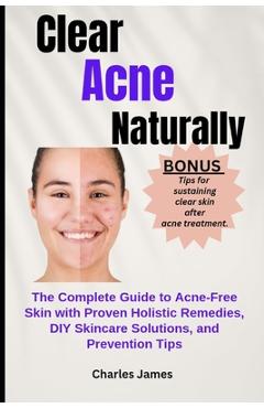 Poza produsului Clear Acne Naturally: The Complete Guide to Acne-Free Skin with Proven Holistic Remedies, DIY Skincare Solutions, and Prevention Tips - Charles James