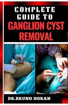 Poza produsului Complete Guide to Ganglion Cyst Removal: Comprehensive Handbook To Expert Techniques, Home Remedies, And Post Surgery Care For Pain Relief And Healing - Bruno Horan