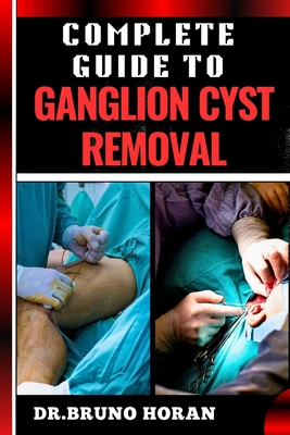 Complete Guide to Ganglion Cyst Removal: Comprehensive Handbook To Expert Techniques, Home Remedies, And Post Surgery Care For Pain Relief And Healing - Bruno Horan