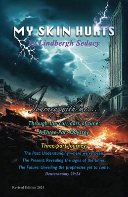 Coperta cărții 'My Skin Hurts - Lindbergh Sedacy'