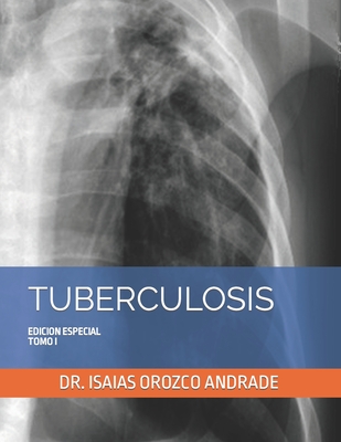 Tuberculosis: Edicion Especial. Tomo I - Isaias Orozco Andrade