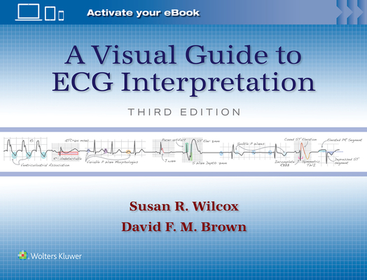A Visual Guide to ECG Interpretation: Print + eBook with Multimedia - Susan Renee Wilcox