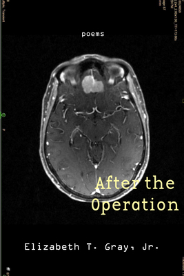 After the Operation - Elizabeth T. Gray