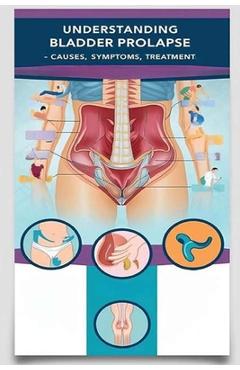 Coperta cărții 'Understanding Bladder Prolapse - Causes, Symptoms, Treatment: Bladder prolapse happens when your bladder pushes through'