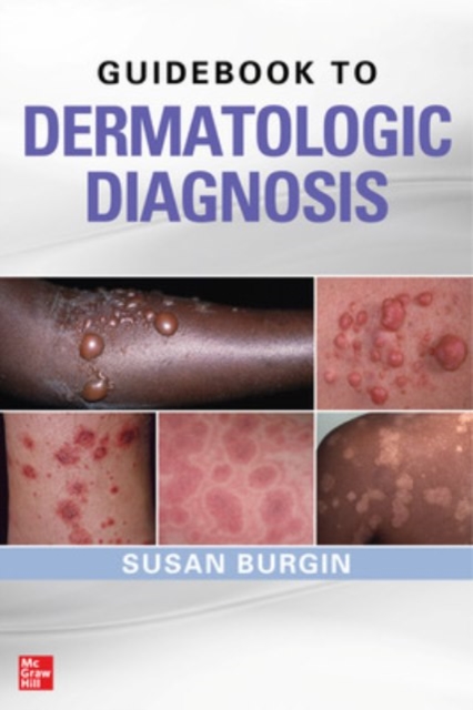Guidebook to Dermatologic Diagnosis - Susan Burgin