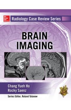 Coperta cărții 'Radiology Case Review Series: Brain Imaging - Chang|saenz Ho'