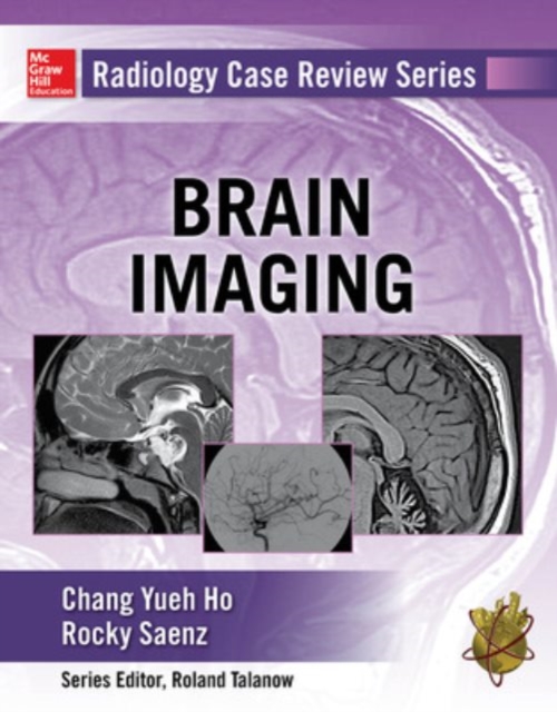 Coperta cărții 'Radiology Case Review Series: Brain Imaging - Chang|saenz Ho'