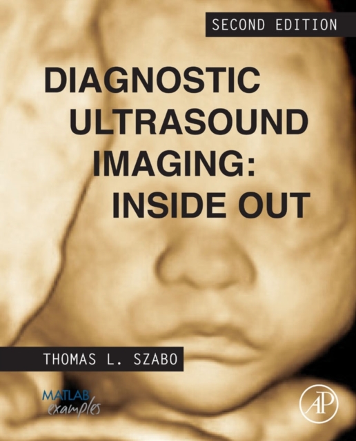 Diagnostic Ultrasound Imaging: Inside Out - Thomas L. (research Professor Szabo