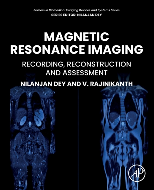 Magnetic Resonance Imaging - V. (professor Rajinikanth