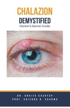 Poza produsului Chalazion Demystified: Doctor's Secret Guide - Ankita Kashyap