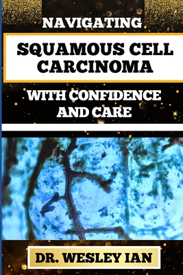 Navigating Squamous Cell Carcinoma with Confidence and Care: Empowering Strategies And Finding Strength For Confronting Cell Cancer For Holistic Recov - Wesley Ian