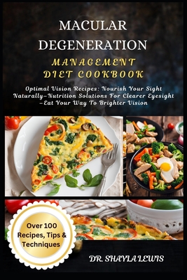 Macular Degeneration Management Diet Cookbook: Optimal Vision Recipes: Nourish Your Sight Naturally-Nutrition Solutions For Clearer Eyesight -Eat Your - Shayla Lewis
