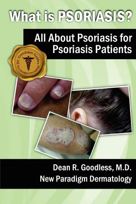 What is Psoriasis?: All About Psoriasis for Psoriasis Patients - Dean R. Goodless Md
