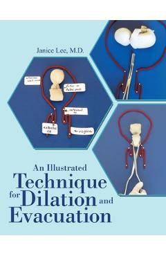 An Illustrated Technique for Dilation and Evacuation - Janice Lee