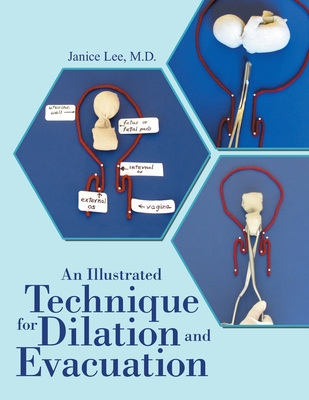 Coperta cărții 'An Illustrated Technique for Dilation and Evacuation - Janice Lee'