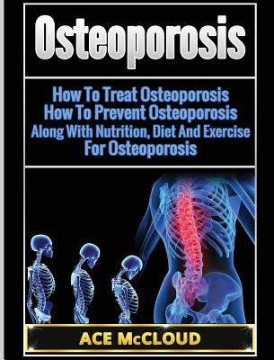 Osteoporosis: How To Treat Osteoporosis: How To Prevent Osteoporosis: Along With Nutrition, Diet And Exercise For Osteoporosis - Ace Mccloud