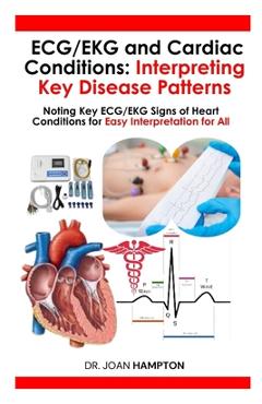 Poza produsului ECG/EKG and Cardiac Conditions: Interpreting Key Disease Patterns: Noting Key ECG/EKG Signs of Heart Conditions for Easy Interpretation for All - Joan Hampton
