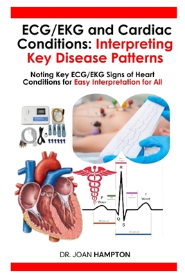 ECG/EKG and Cardiac Conditions: Interpreting Key Disease Patterns: Noting Key ECG/EKG Signs of Heart Conditions for Easy Interpretation for All - Joan Hampton