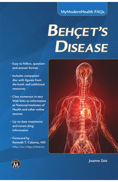 Coperta cărții 'Behcet's Disease - Joanne Zeis'