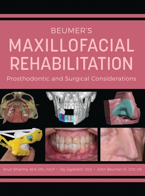Beumer's Maxillofacial Rehabilitation: Prosthodontics and Surgical Considerations - Arun Sharma
