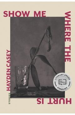 Coperta cărții 'Show Me Where the Hurt Is: Stories - Hayden Casey'