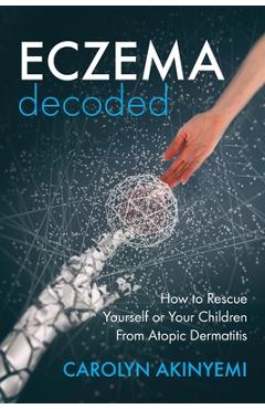 Poza produsului Eczema Decoded: How to Rescue Yourself or Your Children from Atopic Dermatitis - Carolyn Akinyemi