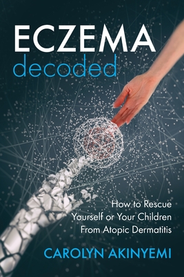 Eczema Decoded: How to Rescue Yourself or Your Children from Atopic Dermatitis - Carolyn Akinyemi