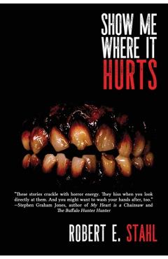 Coperta cărții 'Show Me Where It Hurts - Robert E. Stahl'