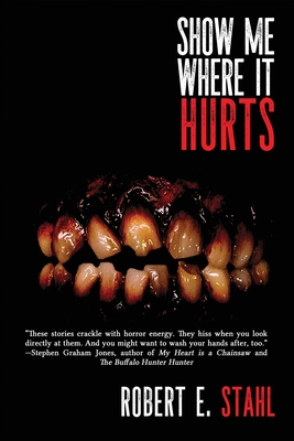 Coperta cărții 'Show Me Where It Hurts - Robert E. Stahl'