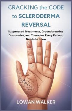 Coperta cărții 'Cracking the Code to Scleroderma Reversal: Suppressed Treatments, Groundbreaking Discoveries, and Therapies Every'