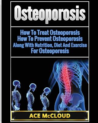 Osteoporosis: How To Treat Osteoporosis: How To Prevent Osteoporosis: Along With Nutrition, Diet And Exercise For Osteoporosis - Ace Mccloud