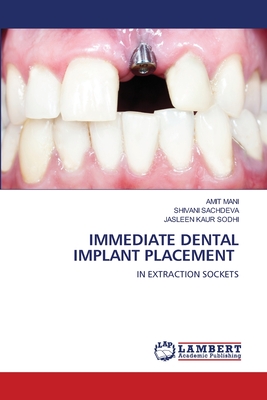 Immediate Dental Implant Placement - Amit Mani