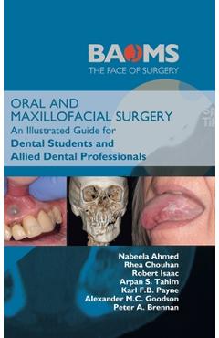 Coperta cărții 'Oral and Maxillofacial Surgery: An Illustrated Guide for Dental Students and Allied Dental Professionals - Nabeela Ahmed'