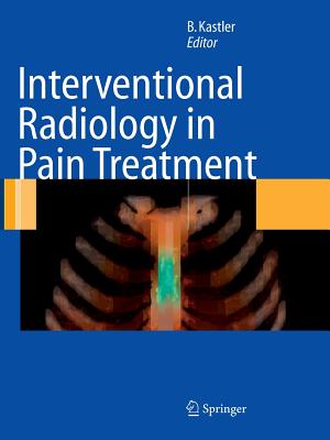 Interventional Radiology in Pain Treatment - F. -g Barral