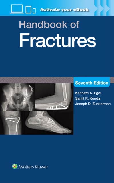 Handbook of Fractures: Print + eBook with Multimedia - Kenneth A. Egol