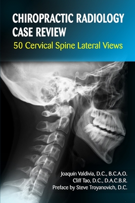 Chiropractic Radiology Case Review: 50 Cervical Spine Lateral Views - Cliff Tao