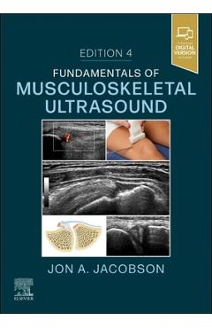Poza produsului Fundamentals of Musculoskeletal Ultrasound - Jon A. Jacobson