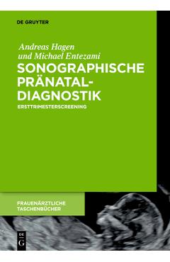 Coperta cărții 'Sonographische Pränataldiagnostik - Andreas Hagen'
