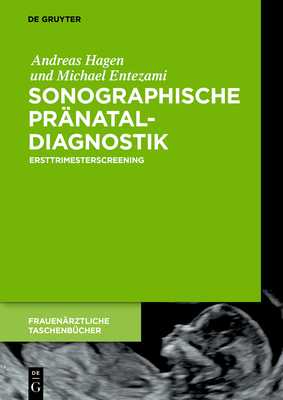 Sonographische Pränataldiagnostik - Andreas Hagen